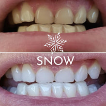 Load image into Gallery viewer, Special Offer - SNOW Teeth Whitening™ System