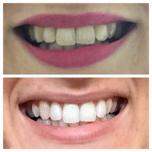 Load image into Gallery viewer, Snow® At-Home Teeth Whitening Kit - 50% Off
